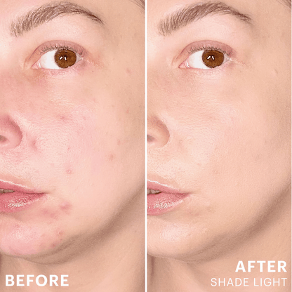 Spot Treat Concealer - Glo Skin Beauty UK&I
